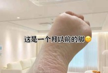 如何应对脚后跟的干裂脱皮问题（预防和治疗脚后跟干裂脱皮的有效方法）